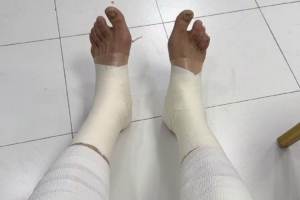 队长担当！媒体人：翟晓川两条腿全拉伤 绑着绷带打了20分钟