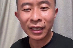 丁佳宁：你NBA什么强度，杨瀚森在CBA用脸挡肘练过来的🤣