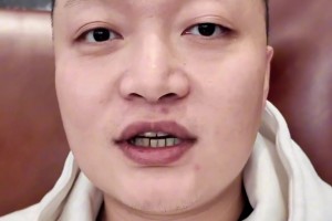 文班18岁的弟弟奥斯卡正效力于法国联赛，跟哥哥比起来很普通